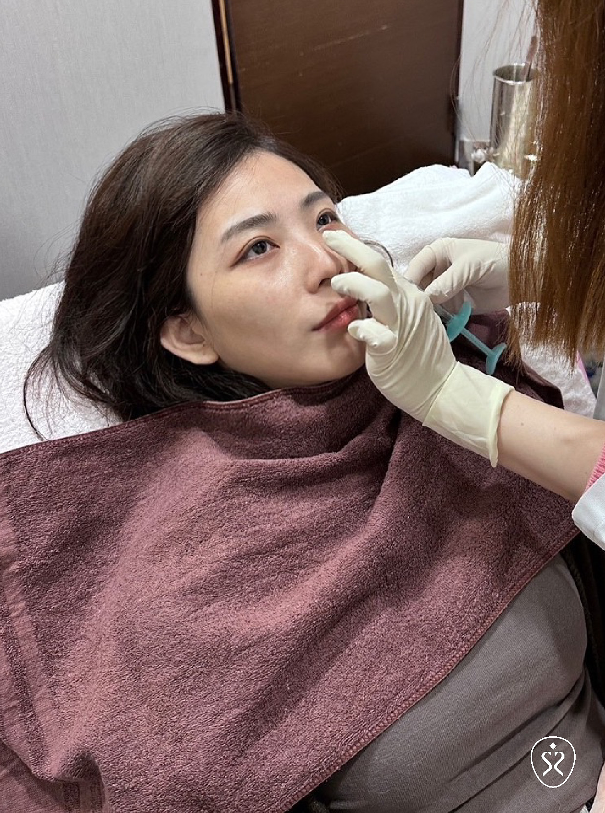 專業醫師評估玻尿酸微整
